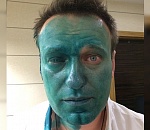 Из-за вчерашнего нападения Навальный перенес поездку в Астрахань