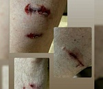 В Астрахани стая собак покалечила мужчину