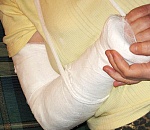 Пьяный астраханец, отбирая телефон у 9-летнего племянника, сломал мальчику руку