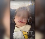 История с пострадавшим на площадке под Астраханью ребенком получила продолжение