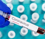 + 855 астраханцев заразились коронавирусом 