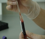 Впервые в России официально объявили эпидемию ВИЧ