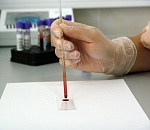 Астраханцев приглашают бесплатно обследоваться на наличие риска сердечно-сосудистых заболеваний