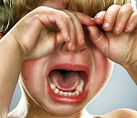 В Астрахани пятилетний малыш серьезно пострадал на детской игровой площадке