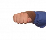 Астраханцу сломали руку из-за телефона