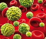 Олег Шеин: астраханцы вдруг перестали умирать от рака?