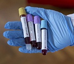 Коронавирус не отступает: за сутки заразились 289 астраханцев