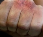 Астраханец сломал нос таксисту, не пожелавшему отвезли его домой после свадебного банкета