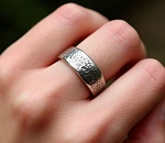 Астраханскому подростку оторвало часть пальца из-за кольца