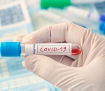 Цифры по коронавирусу в Астрахани снова пугают