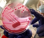 Кишечную палочку обнаружили в водопроводной воде в астраханском селе