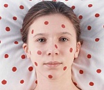 В астраханской детской больнице объявлен карантин