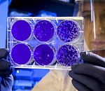 Еще 180 астраханцев заразились коронавирусом