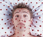 В астраханской школе зарегистрирован случай кори