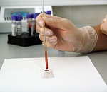 В Астраханской области стали реже умирать от рака