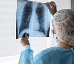 По улицам разгуливает потенциально больной астраханец с опасной инфекцией 