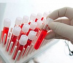 Ещё 170 астраханцев заразились коронавирусом 