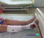 Бездомные собаки изувечили астраханку и ребёнка