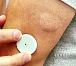 Астраханский антидиабетный проект завершили обеспечением нуждающихся системами мониторинга