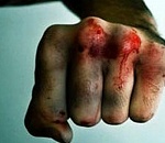 Астраханец жестоко избил подругу, ушедшую на минутку и вернувшуюся через пять часов