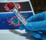 Астраханцы могут бесплатно провериться на антитела к коронавирусу