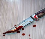 Астраханец выжил, будучи исполосованным ножом