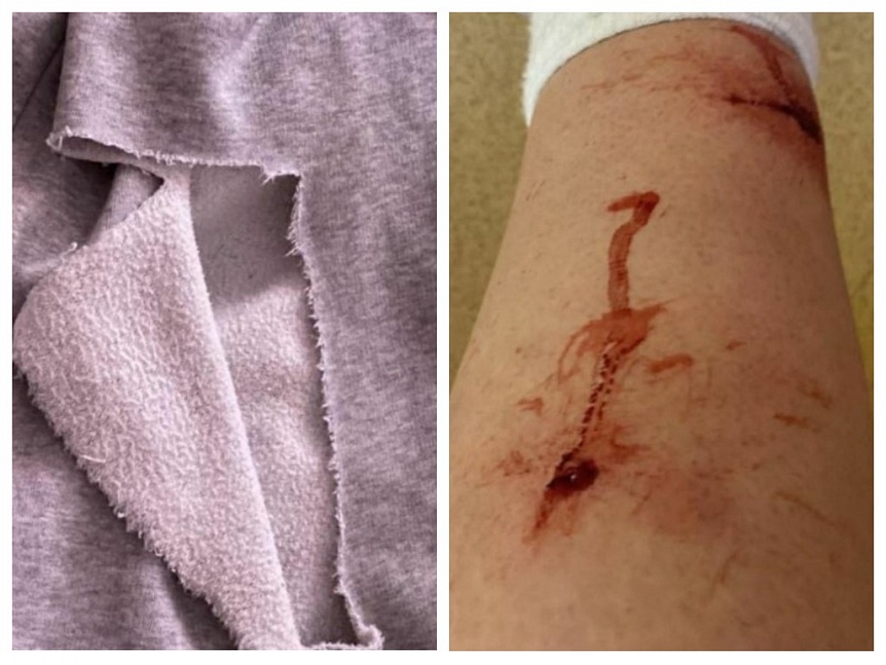 Возле астраханской гимназии более семи собак набросились на выпускницу и покусали ее