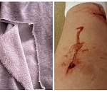 Возле астраханской гимназии более семи собак набросились на выпускницу и покусали ее