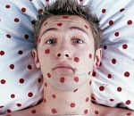  В астраханских школах и детских садах участились случаи кори