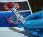 Число случаев коронавируса в Астраханской области превысило 700