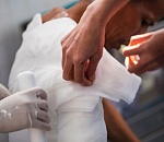 Золотые руки: астраханские врачи спасли пациента с ожогами 70% тела