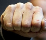 Астраханец сломал нос дорожному полицейскому