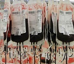 Службам крови в регионах России необходима модернизация