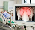 Подробности смерти 63-й жертвы ковида в Астрахани 