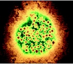 В Астраханской области выросло число случаев вирусного гепатита