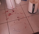 Ревнивая астраханка чуть не отправила на тот свет своего сожителя