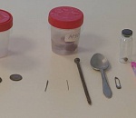 Зубные щётки, ложки и ржавые гвозди: врачи собрали коллекцию предметов, которые проглотили астраханцы