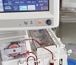 Прорыв в кардиологии: в Астрахани спасают пациентов с зашкаливающим «плохим» холестерином