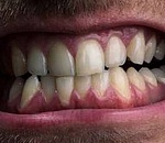 Пьяный астраханец покусал полицейского