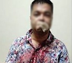 Глава СК России заинтересовался странным нападением на астраханца, который вынужденно переехал из города