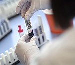 В Астрахани с подозрением на коронавирус проверяют еще восьмерых человек