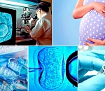 370 астраханкам будут делать ЭКО бесплатно