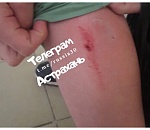 Стая собак набросилась на ребенка в Астрахани