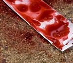 В Астрахани нашли тело пенсионера с отрезанным половым органом