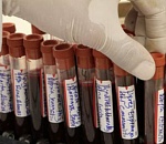 Еще 12 астраханцев заболели корью