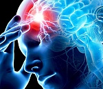 Астраханцев приглашают на День открытых дверей в рамках Дня борьбы с инсультом