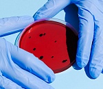 Более 7 тысяч астраханцев болеют коронавирусом прямо сейчас