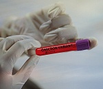 Число заразившихся за сутки в Астраханской области чуточку возросло