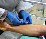 Теперь в Астраханской области по программе диспансеризации будет проводиться анализ на гепатит С 