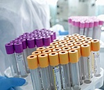 Напряженная коронавирусная картина дня в Астрахани: зараженных и умерших меньше не становится